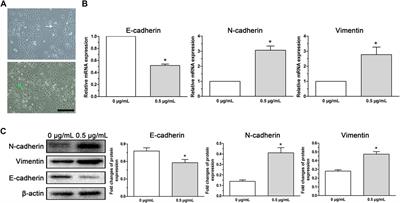 CNTN-1 Upregulation Induced by Low-Dose Cisplatin Promotes Malignant Progression of Lung Adenocarcinoma Cells via Activation of Epithelial-Mesenchymal Transition